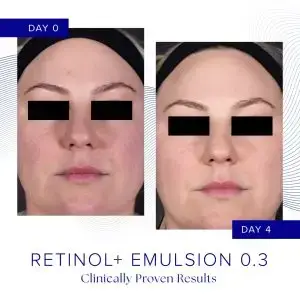Womans face before and after using ISClinical Retinol Emulsion